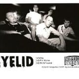 Eyelid