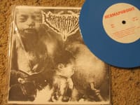 Surgical Cut By Prurulent Womb Of Genital
