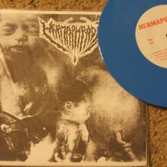 Surgical Cut By Prurulent Womb Of Genital