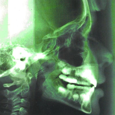 Apulanta - Aivan Kuin Kaikki Muutkin (Backstage Rock Shop, BRS019) · LP, Album, Ltd, Num, RE, RM, Gre