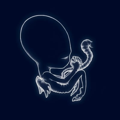 Sigur Rós - Ágætis Byrjun (Krúnk, KRUNK8VMP) · 2xLP · Blue [Deep Blue], Gatefold · M/M · Club Edition, Reissue, Remastered