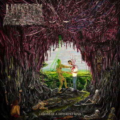 Undeath - Lesions Of A Different Kind (Prosthetic Records, PROS104441) · LP · Slime Green · NM/NM · Limited Edition, Repress